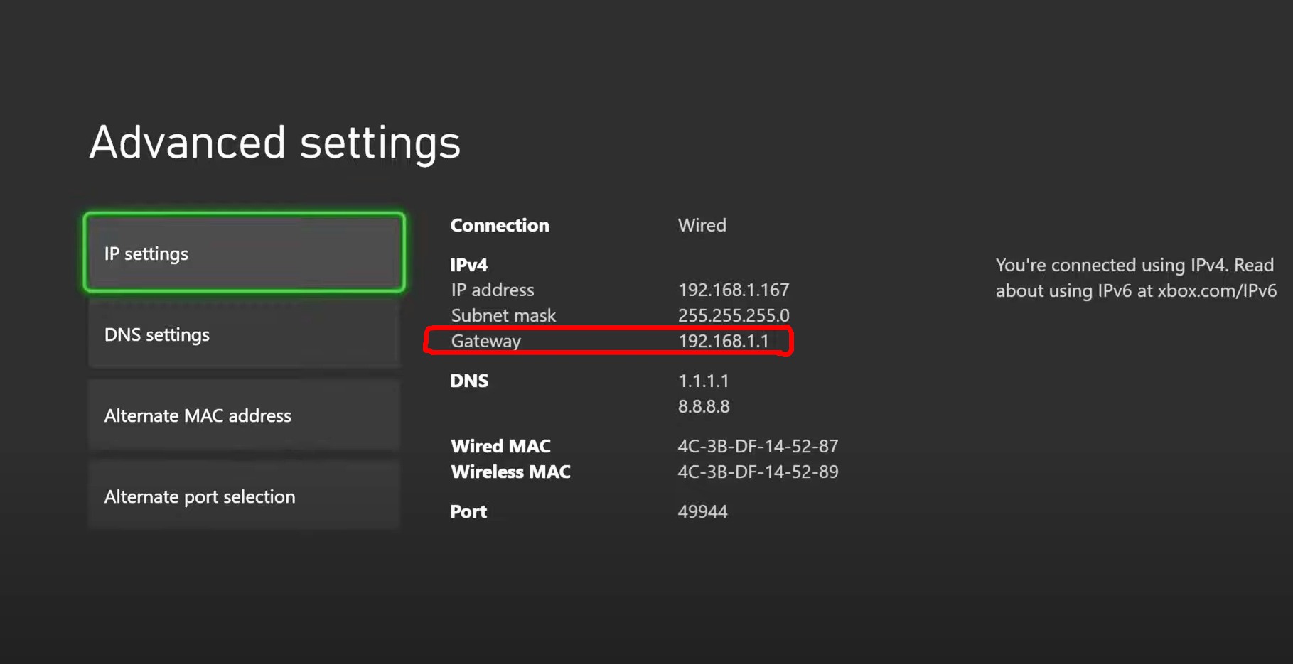 can't assign ip address xbox