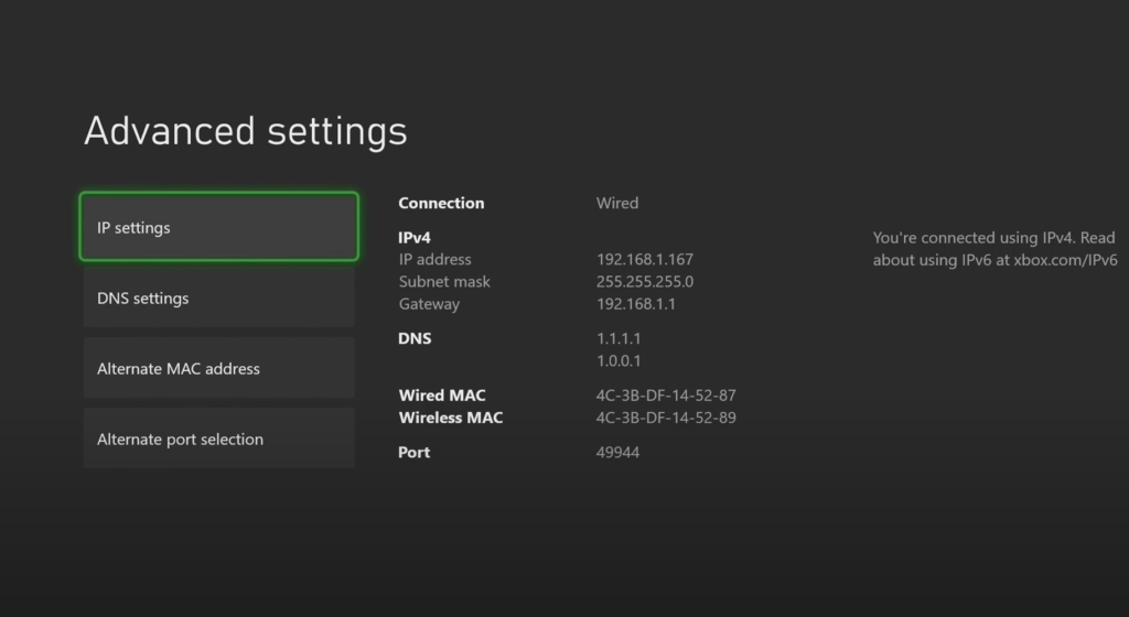 Xbox Series X IP Settings Menu