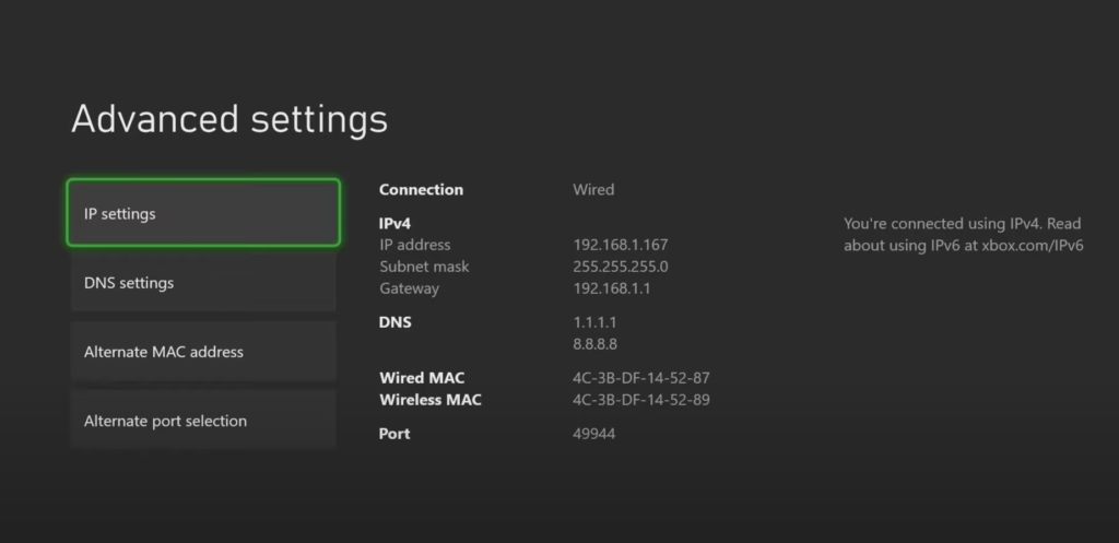 Xbox Series X IP Settings