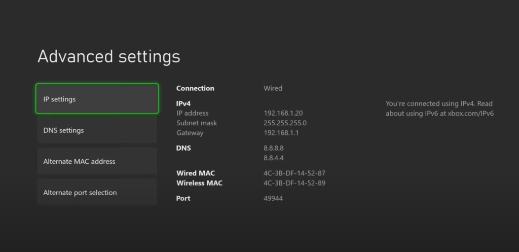 Xbox Series X Static IP Information